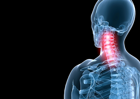 은평더바른신경외과 거북목증후군